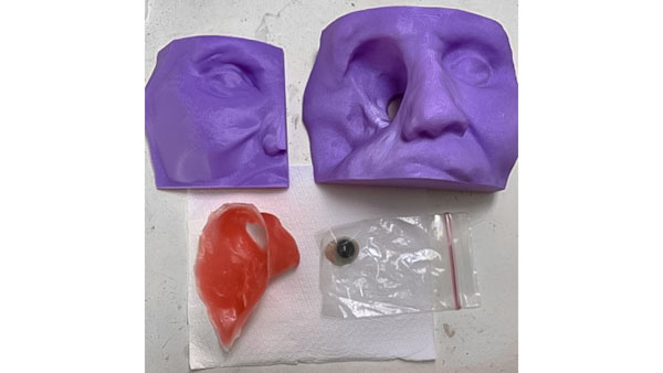 Abbildung 5: Lolas 3D-gedrucktes Gesicht und das Designmuster für die Silikonepithese