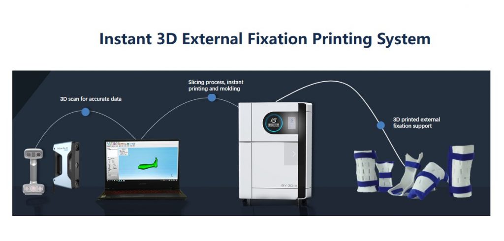 Instant 3D External Fixation Printing System