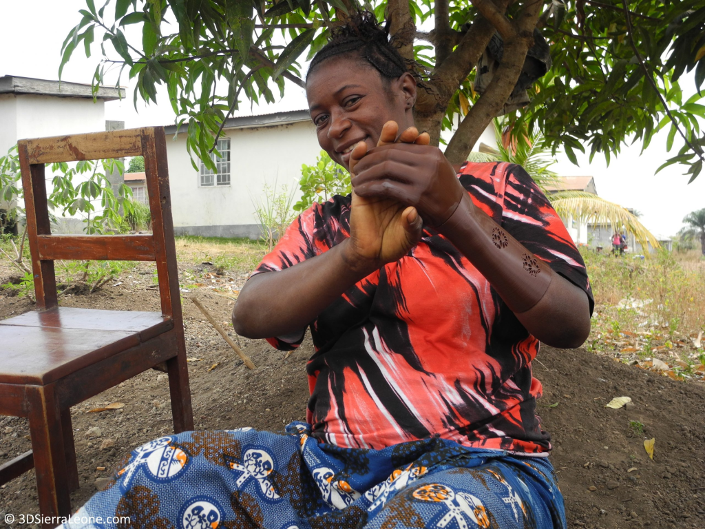 Mariatsu lost her hand during the civil war around 25 years ago and now proudly wears her 3D printed prosthetic hand.