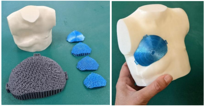 Modelos corporales de pacientes impresos en 3D y diversos modelos de protectores pectorales